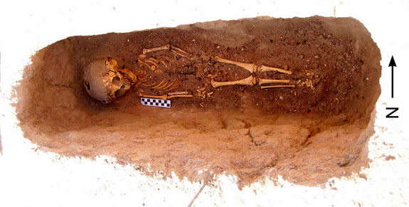 When the researchers came across the abused toddler, labeled "Burial 519," in Kellis 2, nothing seemed out of the ordinary at first. But when they began brushing the sand away, they noticed prominent fractures on the child's arms. The excavated