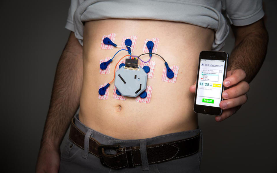 Researchers have created a wearable monitor that can track your stomach's