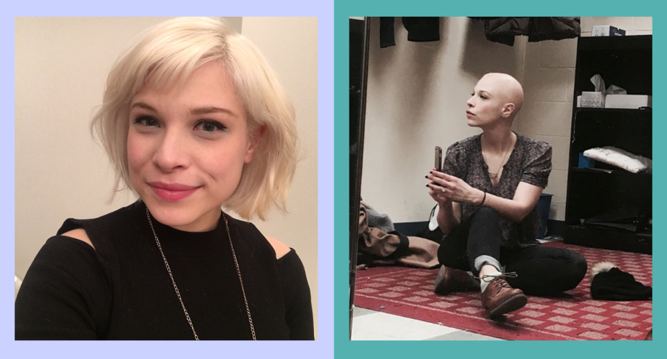 Lauren Marcus before and after being diagnosed with alopecia. (Photos: Lauren Marcus; artwork, Quinn Lemmers for Yahoo Lifestyle)