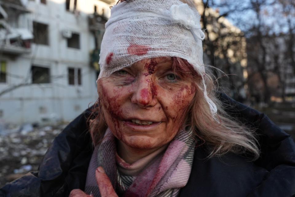 A woman with a bandaged head and bloodied face stands before a damaged building