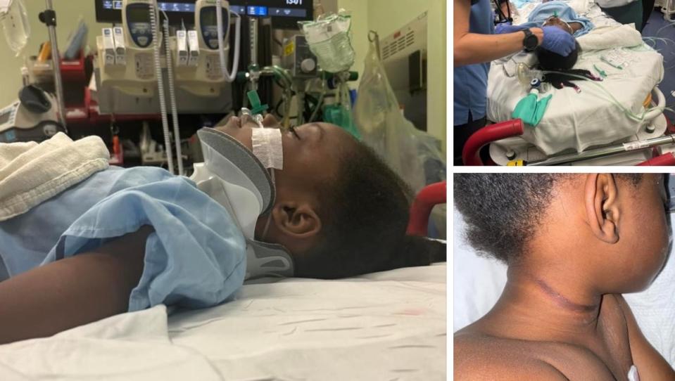 Marley, 5, was taken to the ICU after being strangled by a jump rope in a freak accident at a summer camp (GoFundMe)