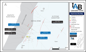 Doyle Zone plan map.