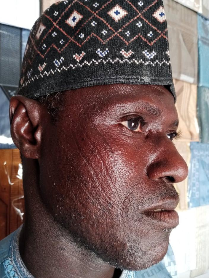 A man in traditional Hausa cap