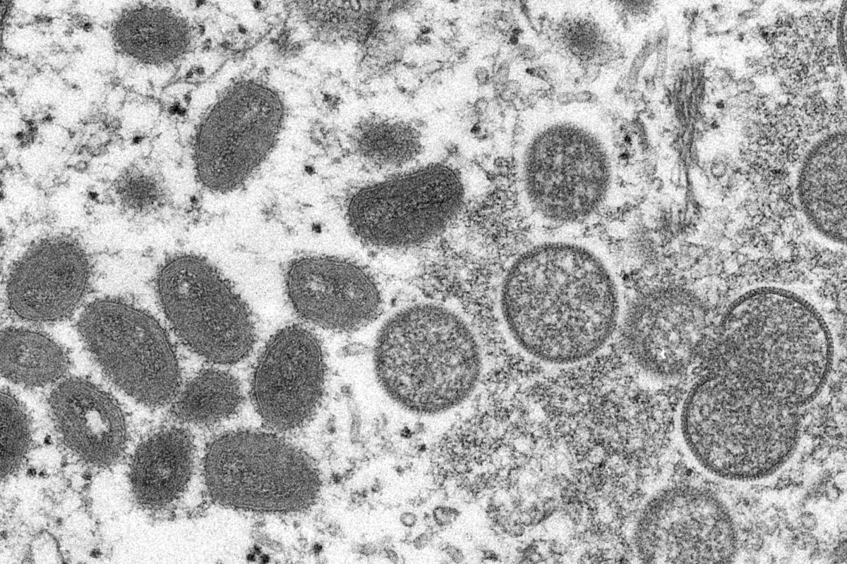 Le CDC africain affirme que le changement de nom des variantes du monkeypox réduit la stigmatisation
