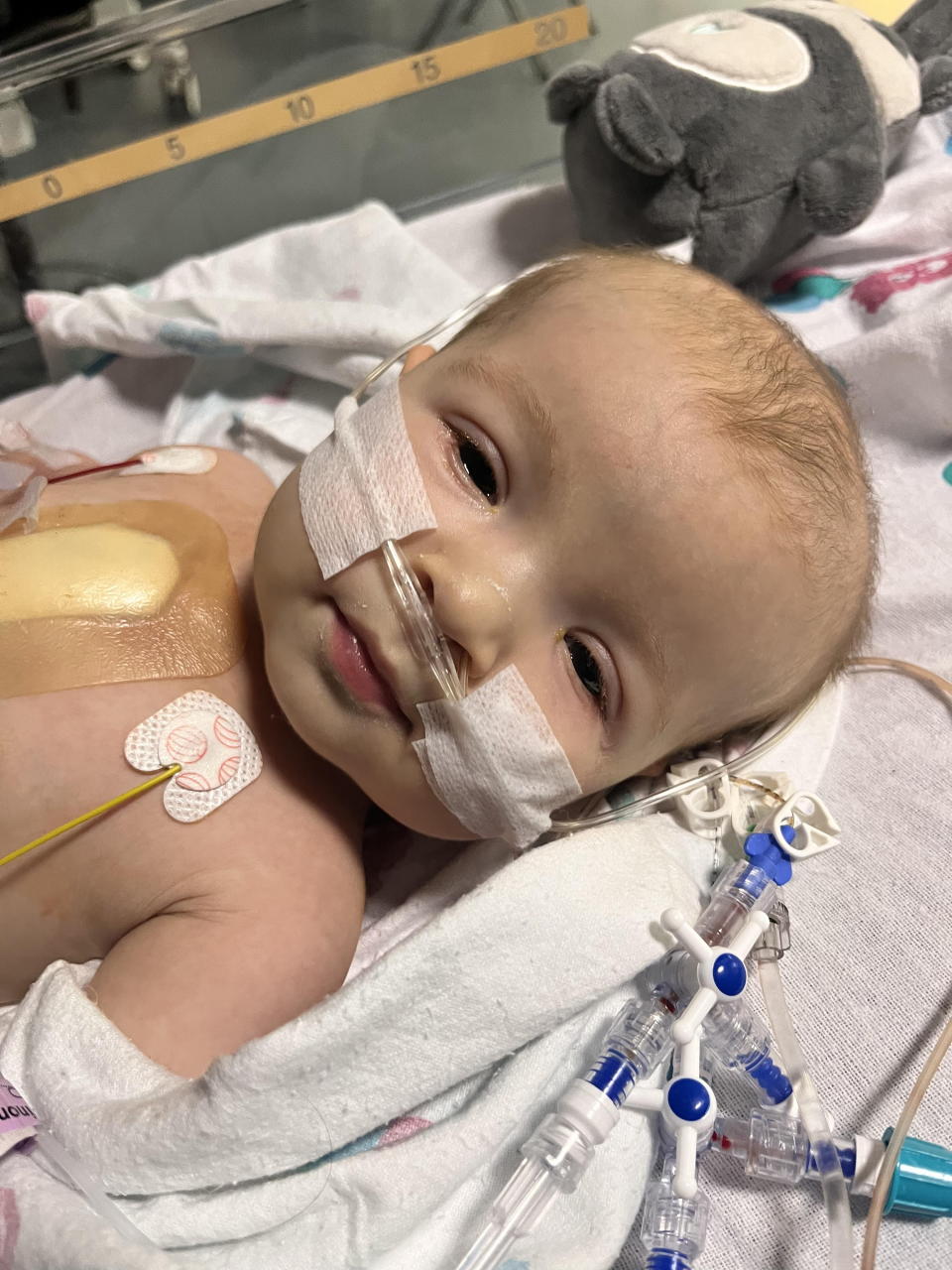 Ava-Rose in hospital recovering from surgery. (Charlotte Lake/SWNS)
