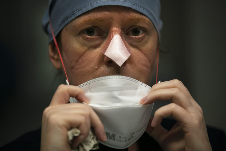 Nurse Danielle Smith shows indentations on her face while working in a COVID-19 unit at El Centro Regional Medical Center in El Centro, Calif., Tuesday, July 21, 2020. (AP Photo/Jae C. Hong)