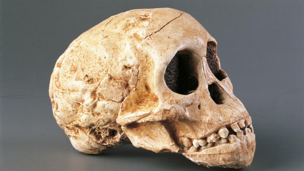 A human skull. 
