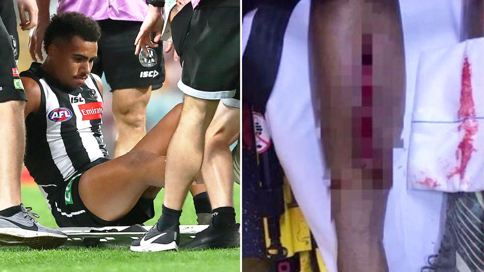 Seen here, Isaac Quaynor and the horrific leg injury he suffered against Sydney.