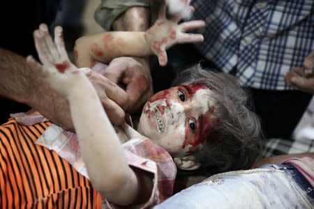 A child reacts inside a field hospital after airstrikes in the rebel held Douma neighbourhood of Damascus, Syria. REUTERS/Bassam Khabieh