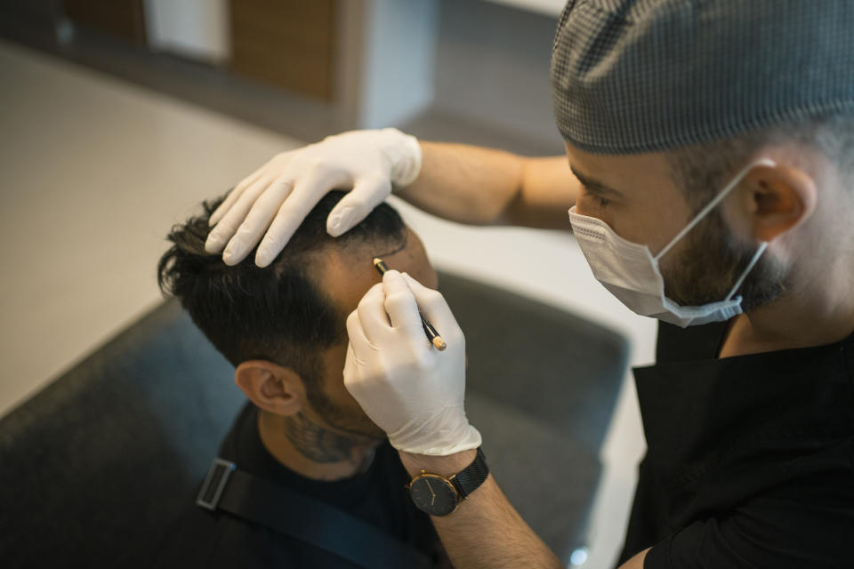 A doctor drawing a line on a patient's hairline