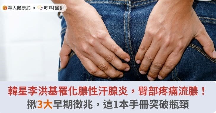 韓星李洪基罹化膿性汗腺炎，臀部疼痛流膿！揪3大早期徵兆，這1本手冊突破瓶頸