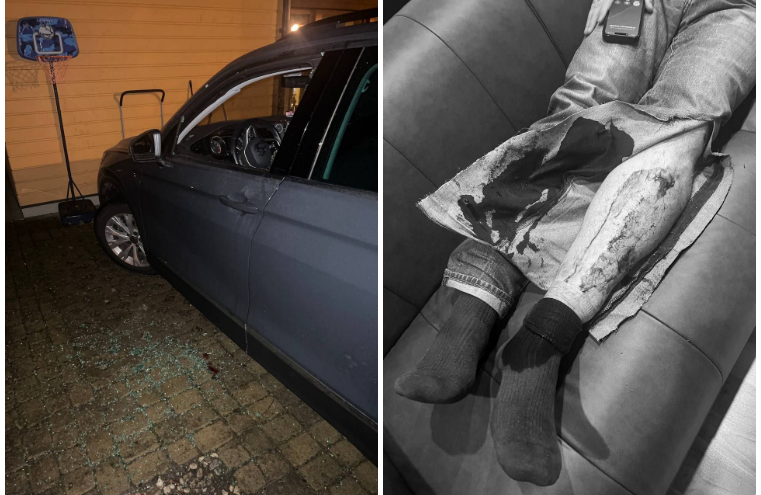 <strong>沃爾科夫的汽車窗戶被敲碎，歹徒持錘子攻擊他的手腳。（圖／翻攝自X）</strong>