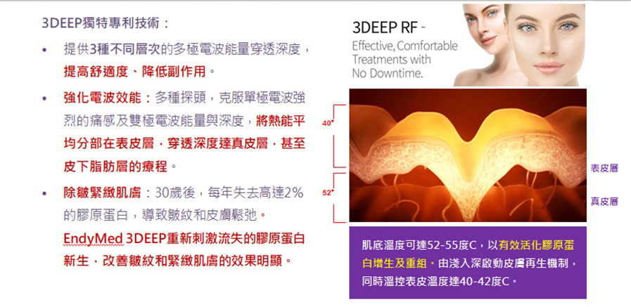 新一代女王電波－免打麻醉，揮別紋路、鬆垮垂