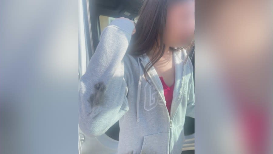 6th grade SoCal girl brutally attacked by classmate