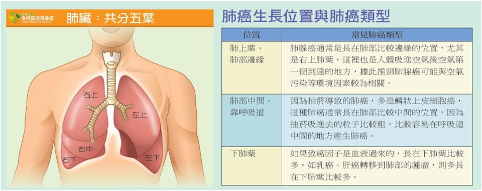 肺癌生長位置與肺癌類型