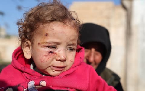 A woman holds an injured girl by last night's Syrian regime bombardment on a makeshift camp in the village of Qah - Credit: AFP