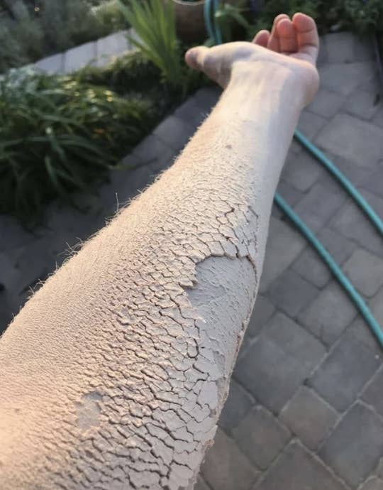 a person's arm covered in saw dust, looking like it is crumbling away