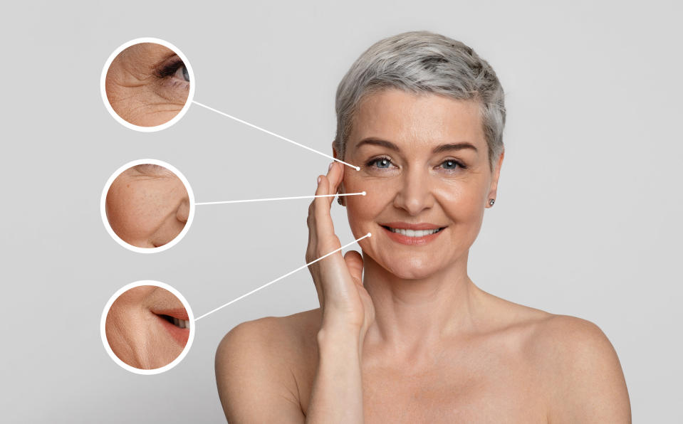 Arrows pointing out a woman's aging skin