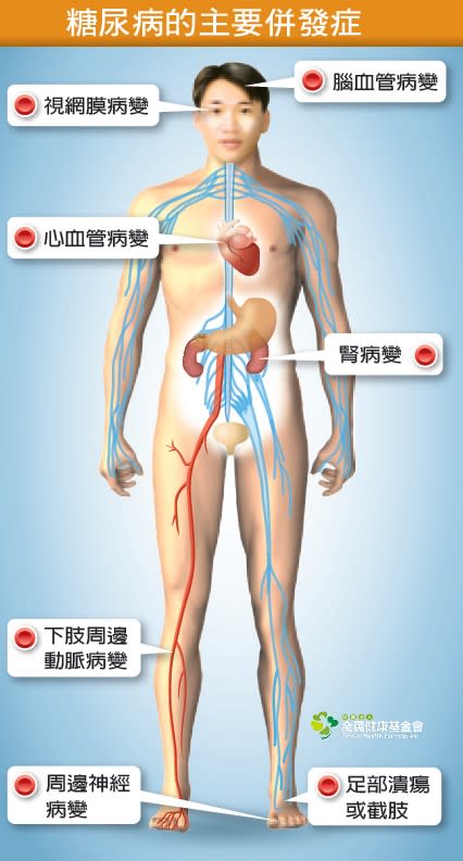 糖尿病的主要併發症