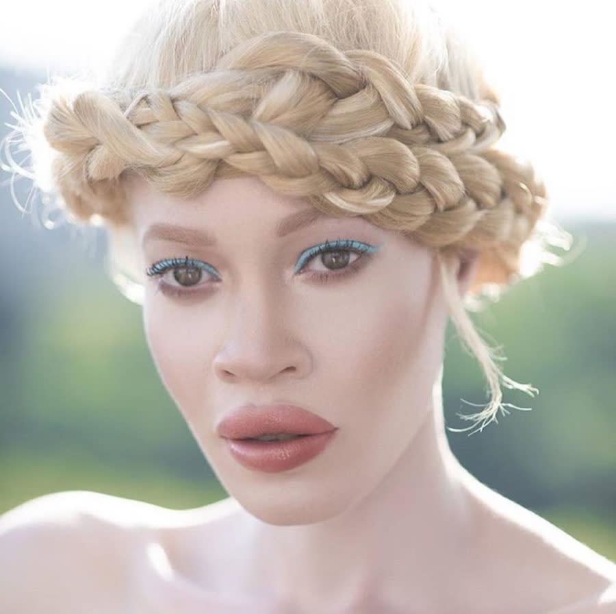 Wet n Wild chose a model with albinism as the face of its new beauty campaign