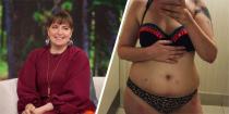 <p>Lena Dunham has <a href="https://www.cosmopolitan.com/uk/body/health/a17809407/lena-dunham-full-hysterectomy-endometriosis/" rel="nofollow noopener" target="_blank" data-ylk="slk:famously documented her experience with endometriosis;elm:context_link;itc:0;sec:content-canvas" class="link ">famously documented her experience with endometriosis</a>, and the resulting impact it's had on her body. One of those repercussions is <a href="https://www.cosmopolitan.com/uk/body/health/news/a45953/lena-dunham-shares-pictures-endometriosis-scars-instagram/" rel="nofollow noopener" target="_blank" data-ylk="slk:a series of scars from various operations;elm:context_link;itc:0;sec:content-canvas" class="link ">a series of scars from various operations</a> she's had to undergo, but it's not left her feeling uncomfortable with the way she looks. In 2016, Lena posted a picture of her in a bikini in the Target changing rooms, and captioned it: "When the Target swimsuit does a bitch right, endo scars & all".</p>