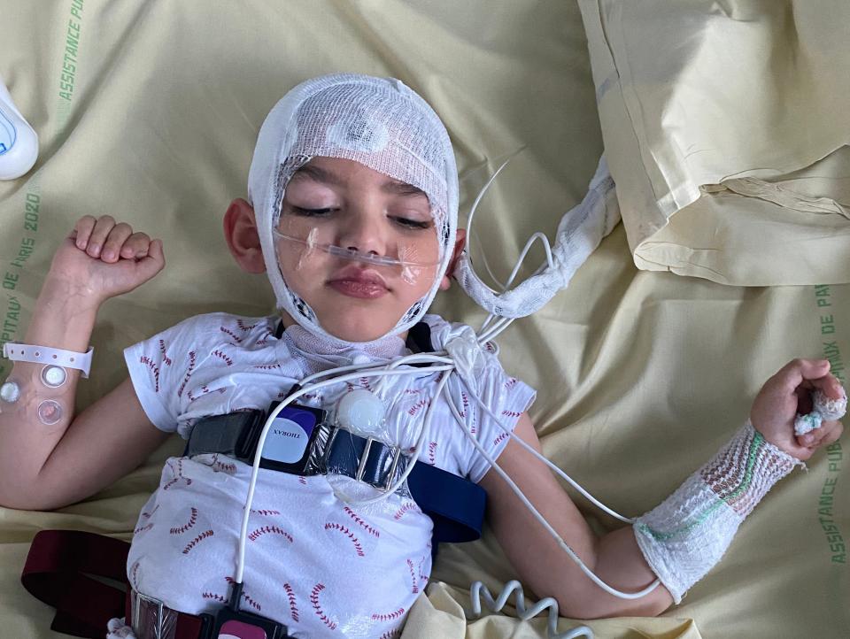 Leo Vauclare, who has a rare genetic condition, lies on a hospital bed during a drug trial, covered in tubes, wires and bandages.
