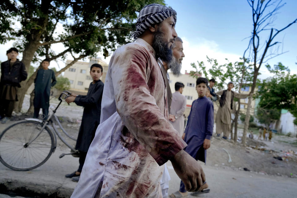 FILE - An Afghan blood-stained worshiper walks around the mosque where the explosion occurred in Kabul, Afghanistan, Friday, April 29, 2022. A powerful blast ripped through a mosque in the Afghan capital of Kabul on Friday, killing at least ten people and wounding others, a Taliban spokesman said. (AP Photo/Ebrahim Noroozi, File)