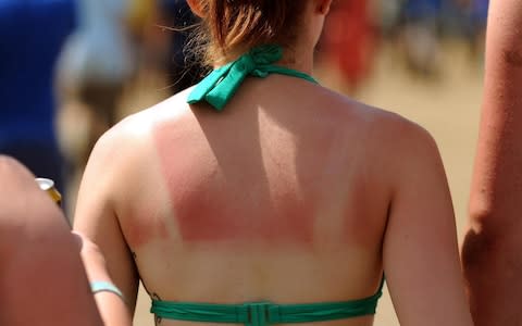 Wear sun cream or cover up to avoid sunburn, health bodies have warned - Credit:  Anthony Devlin/PA