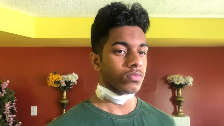 'I was lucky': Teen attacked in unprovoked daytime stabbing released from hospital