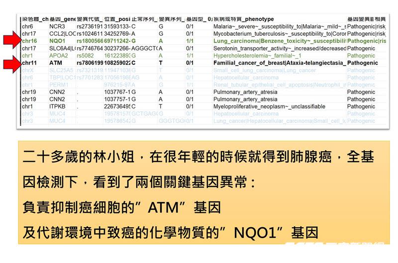 定期的健康檢查或做全基因檢查，可以更瞭解自己的身體狀況，避免後天因素誘發生病、罹癌。（圖／資料照）