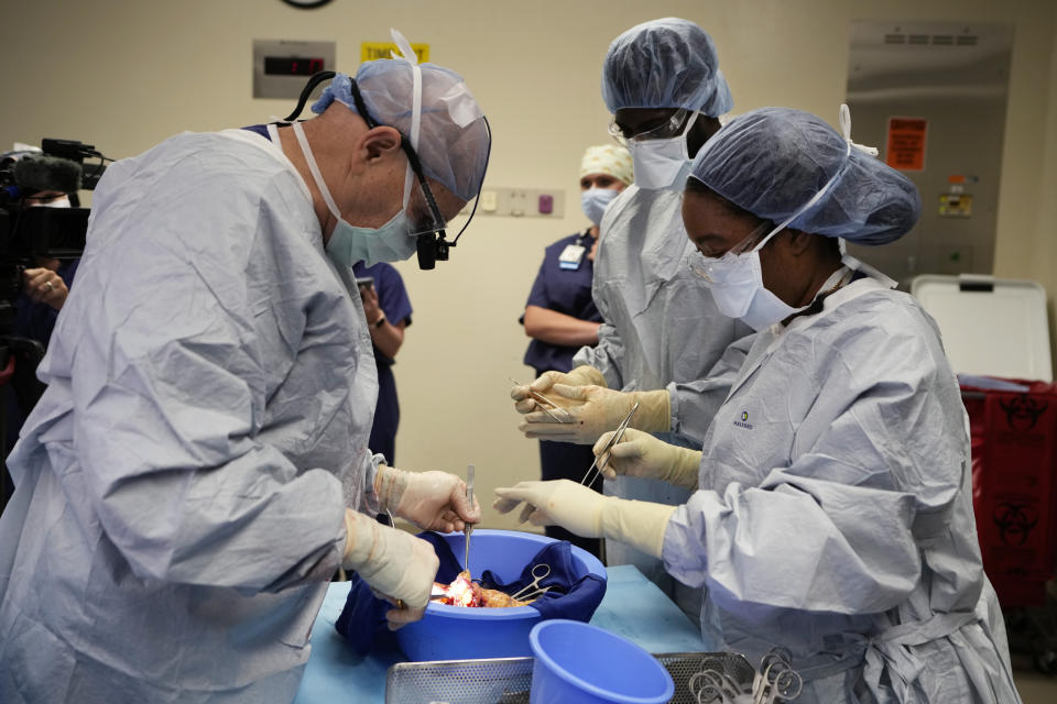 Dr. Marty Sellers, left, and Meharry Medical College students Emmanuel Kotey, second from right, and Teresa Belledent, right, examine a kidney after it was removed from an organ donor on June 15, 2023, in Jackson, Tenn. Cancer was later found in the donor’s lungs so the kidney couldn’t be used for transplant. (AP Photo/Mark Humphrey)