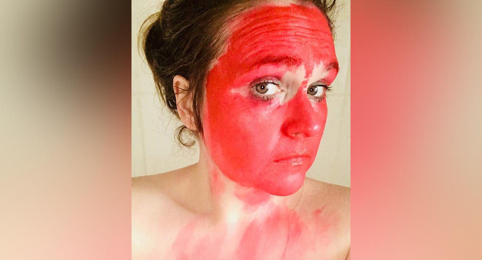 Halloween fail: Yorkshire mum Leanne Short's clown paint lip stain left her with a red face for days.