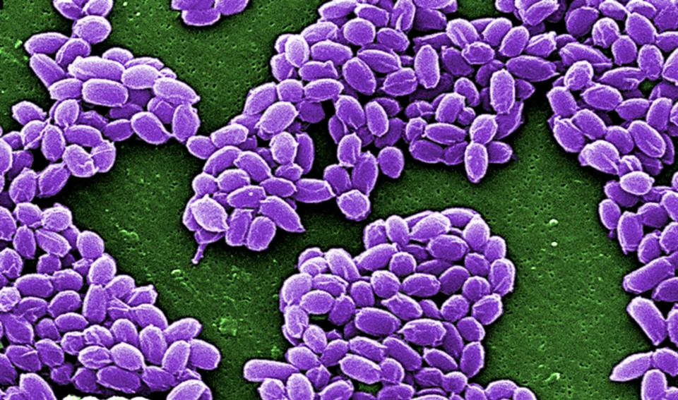 Spores from the Sterne strain of anthrax bacteria (Bacillus anthracis) are pictured in this handout scanning electron micrograph (SEM) obtained by Reuters May 28, 2015. The U.S. military mistakenly sent live anthrax bacteria to laboratories in nine U.S. states and a U.S. air base in South Korea, after apparently failing to properly inactivate the bacteria last year, U.S. officials said on May 27, 2015. REUTERS/Center for Disease Control/Handout via Reuters THIS IMAGE HAS BEEN SUPPLIED BY A THIRD PARTY. IT IS DISTRIBUTED, EXACTLY AS RECEIVED BY REUTERS, AS A SERVICE TO CLIENTS. FOR EDITORIAL USE ONLY. NOT FOR SALE FOR MARKETING OR ADVERTISING CAMPAIGNS