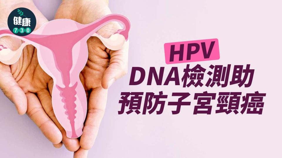 HPV DNA檢測助預防子宮頸癌