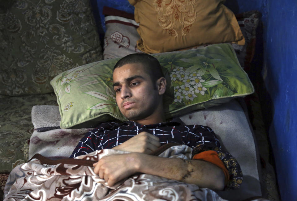 Nawid, a 21-year-old student who lost his brother and who was himself wounded in a deadly Taliban suicide attack on the Afghan capital's Green Village neighborhood earlier this month, lies in bed at home during an interview with The Associated Press, in Kabul, Afghanistan, Tuesday, Jan. 29, 2019. Kabul residents are wary of peace talks with the Taliban, even as Afghan officials express hope that negotiations could lead to lasting peace in their war-ravaged country. (AP Photo/Rahmat Gul)