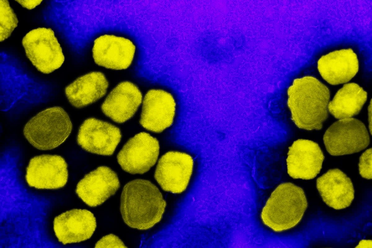 A colorized transmission electron micrograph of monkeypox virus particles (PA Media)