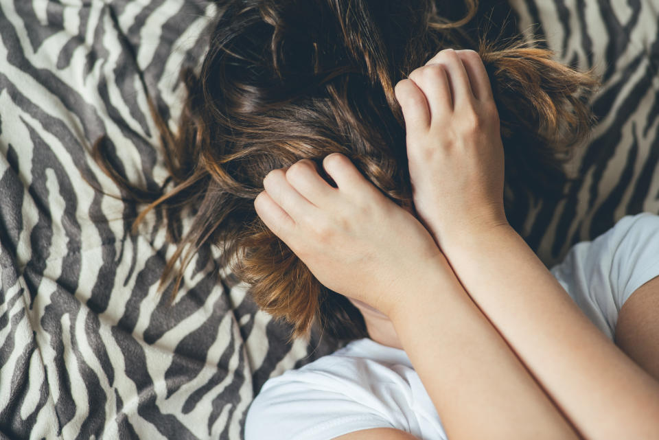 Am liebsten verstecken: Akne ist eine Hauterkrankung, von der über 80 Prozent der Deutschen mindestens einmal im Laufe ihres Lebens betroffen sind. (Symbolbild: Getty Images)