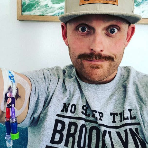 PHOTO: Travis Snyder, of California, is waiting for a bone marrow donation as he continues to fight acute myeloid leukemia. (Courtesy Travis Snyder)