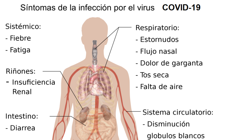 Síntomas del coronavirus COVID-19. (Crédito imagen: Wikipedia).