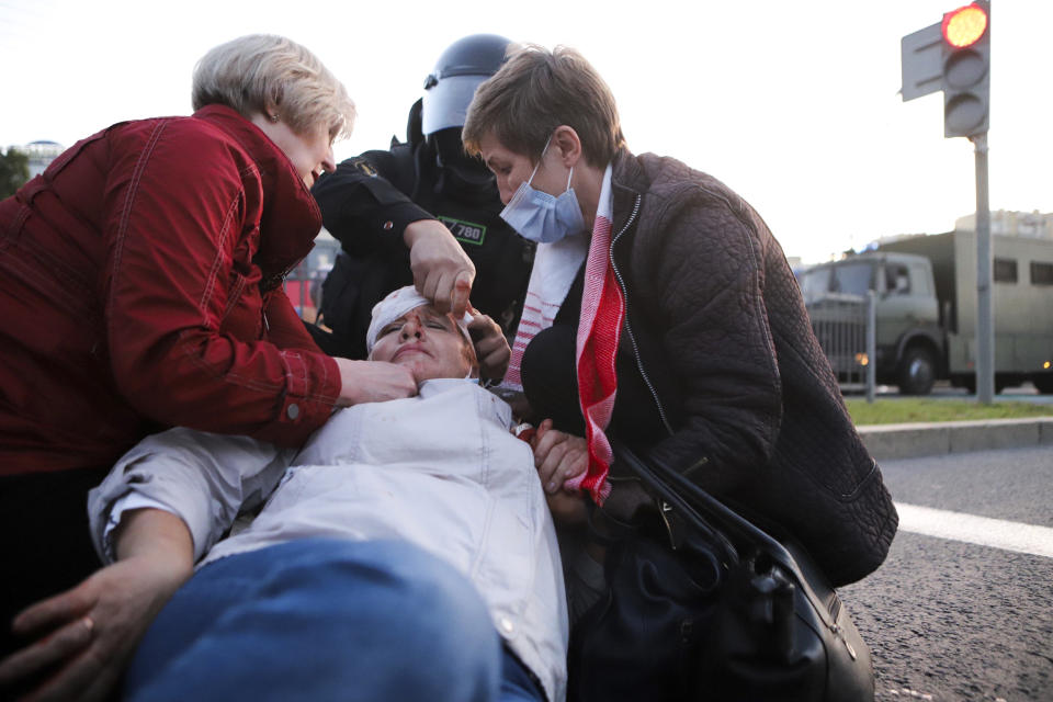 Two women provide a health care to a wounded protester during an opposition rally to protest the presidential inauguration in Minsk, Belarus, Wednesday, Sept. 23, 2020. Belarus President Alexander Lukashenko has been sworn in to his sixth term in office at an inaugural ceremony that was not announced in advance amid weeks of huge protests saying the authoritarian leader's reelection was rigged. Hundreds took to the streets in several cities in the evening to protest the inauguration. (AP Photo)