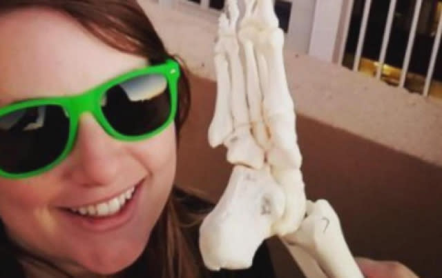 Cancer survivor takes funny Instagram photos with her amputated foot