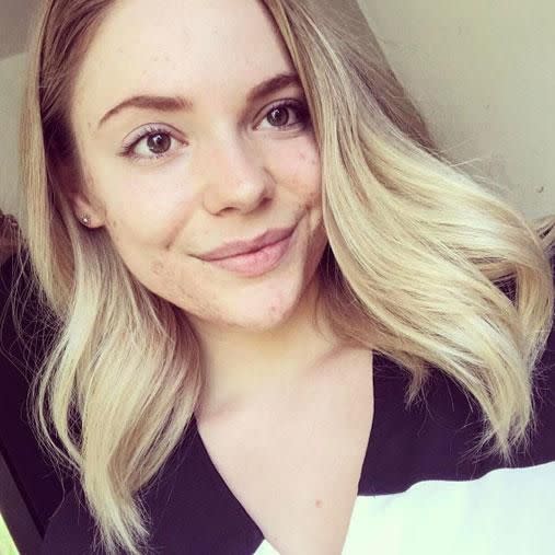 The 22-year-old was inspired to share her journey to help other people suffering from acne. Photo: Instagram