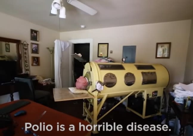 Alexander contracted polio in 1952, when he was 6 years old and living with his family in suburban Dallas. Gizmodo/YouTube