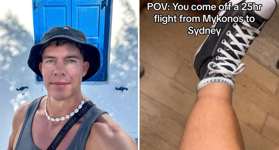 A photo of Tom Dowling in Greece. A photo of his swollen leg after flying from Greece to Australia.