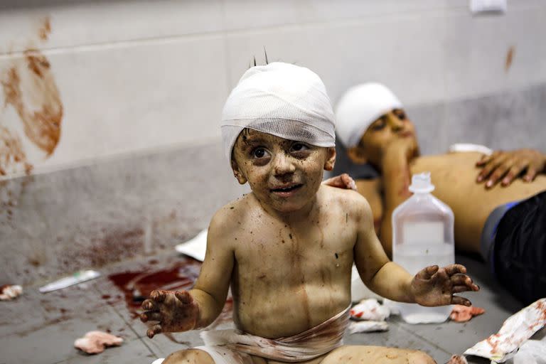 Un niño palestino herido en el hospital Al-Shifa, en la Ciudad de Gaza. (AP/Abed Khaled)