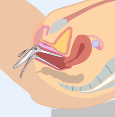 Vaginal speculum diagram.