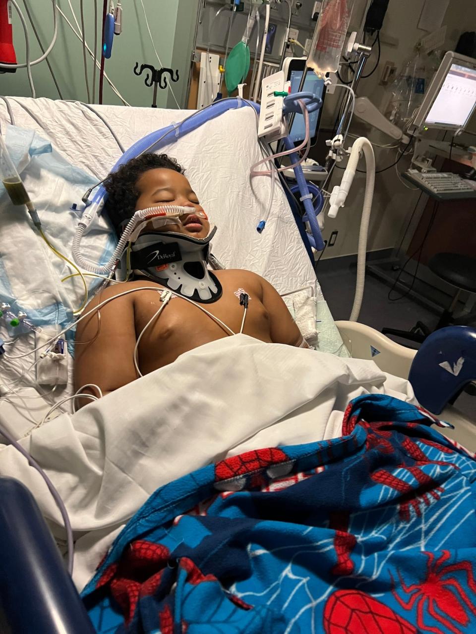 Hooked up to a breathing tube, Jayden Hunter, 7, has been unable to talk or move since he was taken to the hospital after the collision last week. (Submitted by Cora Hunter - image credit)
