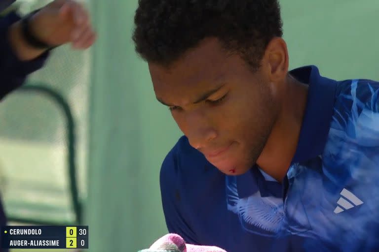 Felix Auger-Aliassime sufrió un ligero corte en su mentón al impactar una devolución