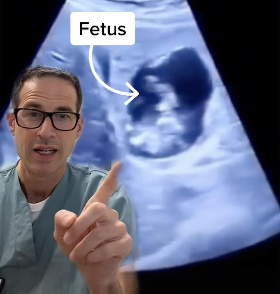 Dr Michael Narvey seen with a fetus growing in a liver.