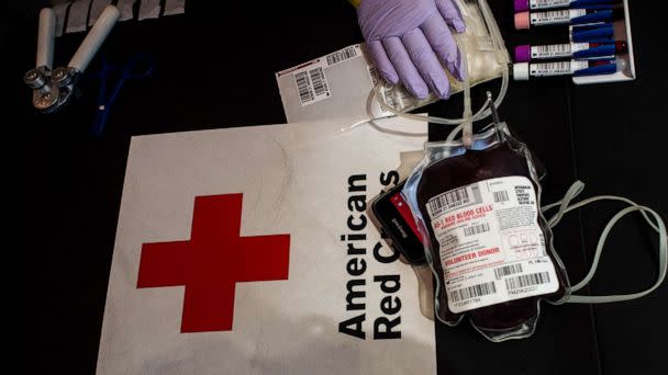 PHOTO: In this March 23, 2021 file photo Phlebotomist Adel Velasco prepares a blood donation at a Red Cross blood drive with L.A. Care Health Plan in Los Angeles. (Sarah Reingewirtz, Los Angeles Daily News/SCNG via Getty Images, FILE)